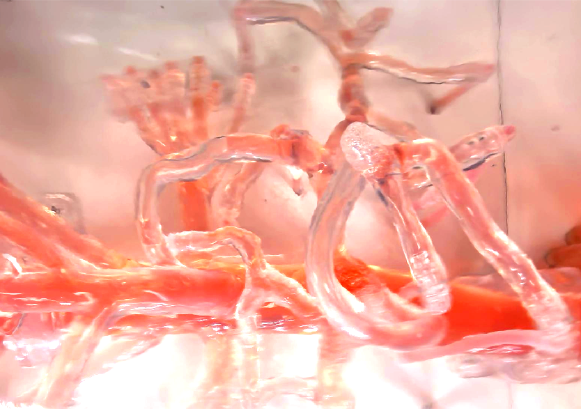 血管介入治療模擬訓練平臺